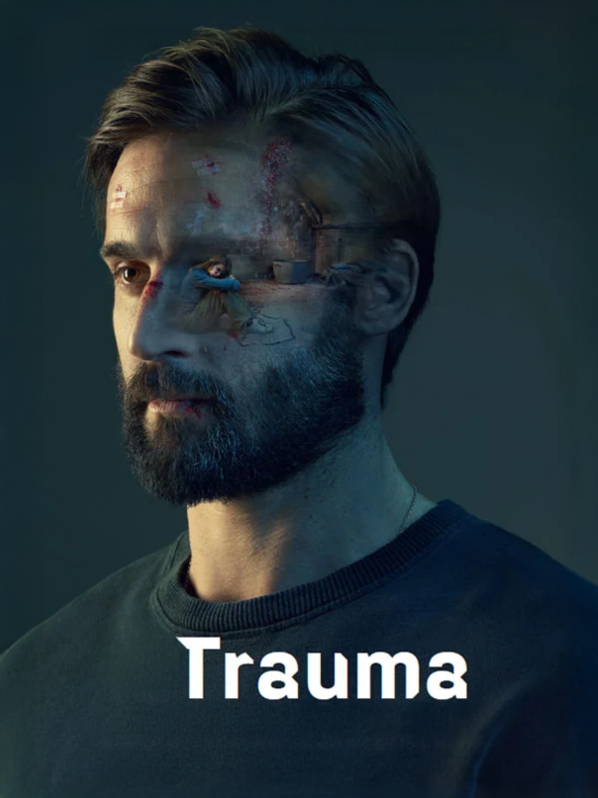 Trauma